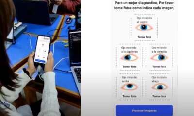 Enfermedad de los ojos