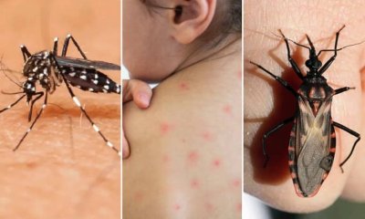 Mal de Chagas